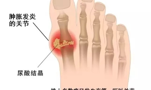 盘鳝吃法口诀-盘鳝吃法网 - 盘鳝鱼怎么做好吃,盘鳝怎么做好吃